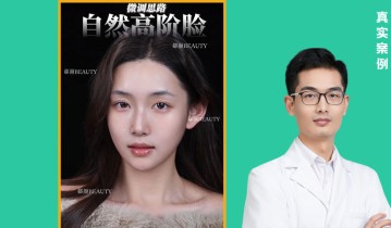 顾六六院长网红脸案例