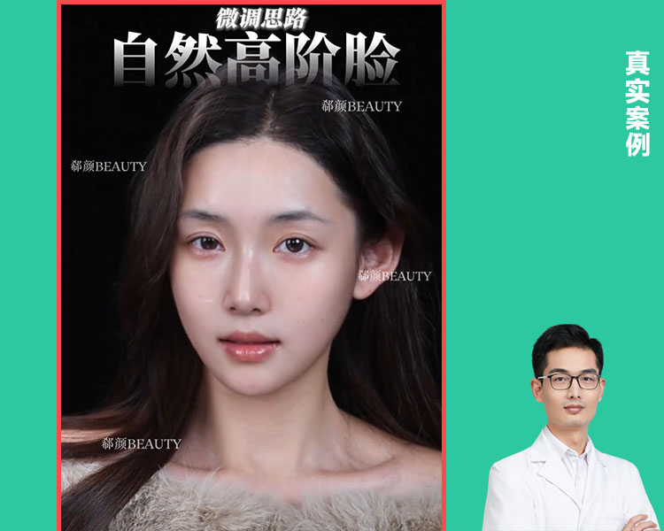 顾六六院长网红脸案例